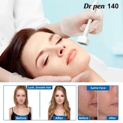Derma Stamp – Microneedling Stempel – Produktansicht 2