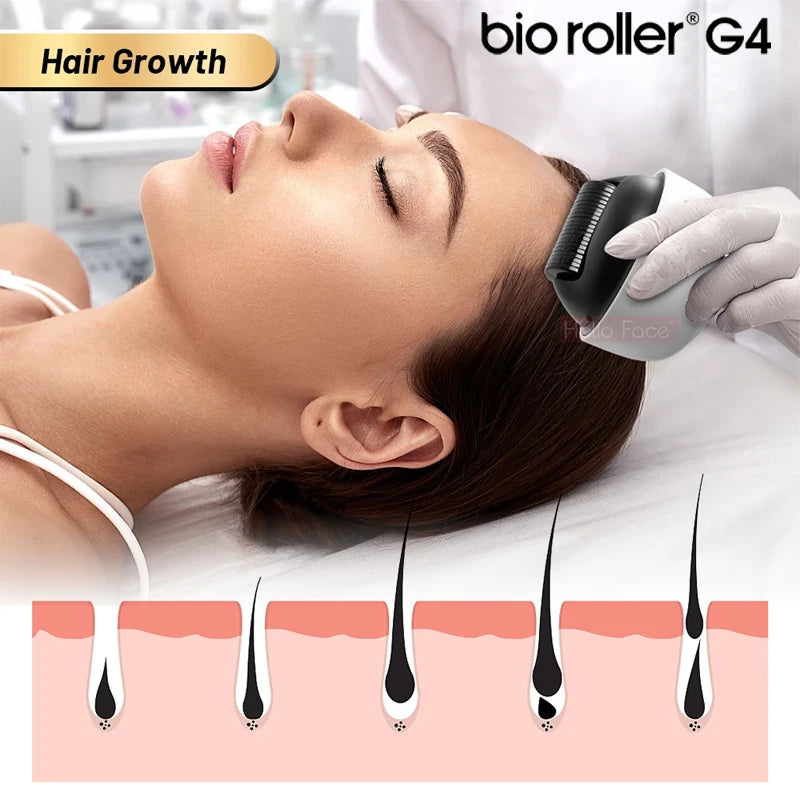 Bio Roller G4 Derma Roller für Haut & Haar (1200 Pins) – Produktansicht 5