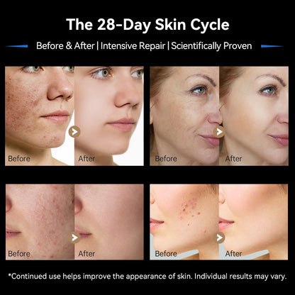 Dr. Pen M9 Pro Wireless Microneedling Pen – Produktansicht 7