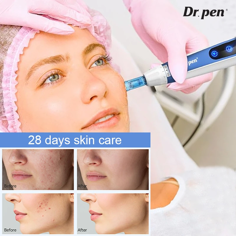 Dr. Pen A11 Ultima Pro Microneedling Pen – Produktansicht 6